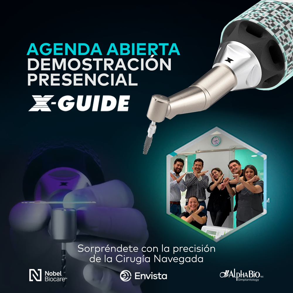 DEMO XGUIDE